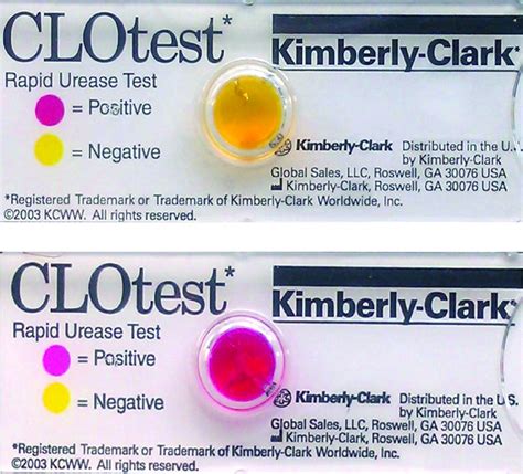 clo test for h pylori